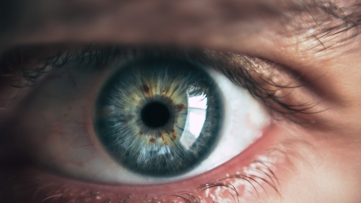 Дефекты глаз, с которыми вы можете столкнуться